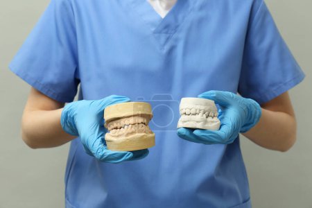 Doctor holding dental models with jaws on grey background, closeup. Cast of teeth