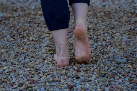 Téléchargez les photos : Image de pieds femelles nus debout sur de petites pierres acérées un pied semelle sale à moitié soulevée vue arrière - en image libre de droit