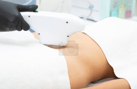 the girl is given laser hair removal on the bikini area. Laser hair removal. body care. Cosmetology