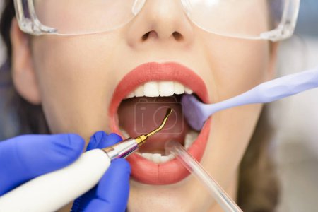 Téléchargez les photos : Jeune patiente pendant l'intervention dentaire - en image libre de droit