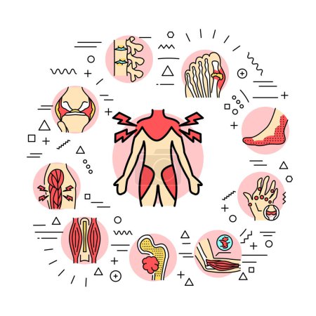Ilustración de Banner web de reumatología. Infografías con iconos lineales - Imagen libre de derechos