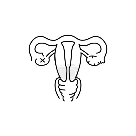 Illustration for Uterine myoma color line icon. Gynecology problem - Royalty Free Image
