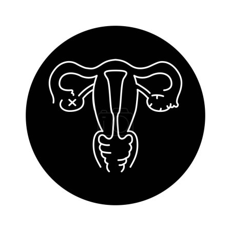 Ilustración de Uterine myoma color line icon. Gynecology problem - Imagen libre de derechos