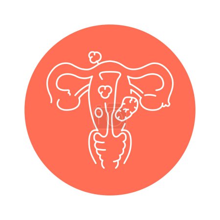Illustration for Uterine myoma color line icon. Gynecology problem - Royalty Free Image