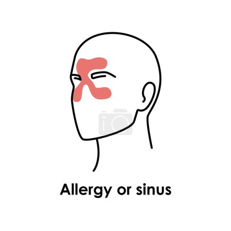Illustration for Allergy or sinus color icon. Vector isolated illustration - Royalty Free Image