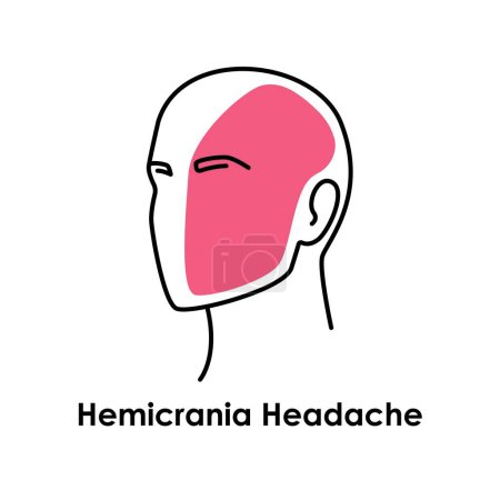 Ilustración de Hemicrania Icono de color de dolor de cabeza. Ilustración aislada vectorial - Imagen libre de derechos