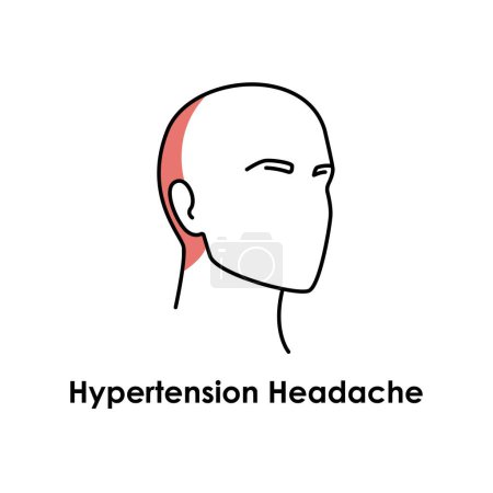 Ilustración de Hipertensión Icono de color de dolor de cabeza. Ilustración aislada vectorial - Imagen libre de derechos