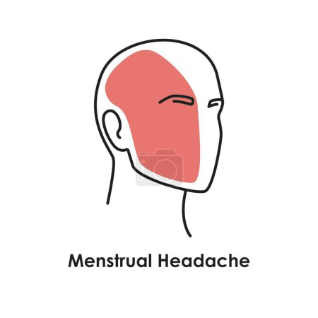 Ilustración de Icono de color de dolor de cabeza menstrual. Ilustración aislada vectorial - Imagen libre de derechos