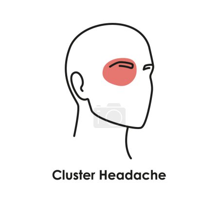 Ilustración de Icono de color de dolor de cabeza en racimo. Ilustración aislada vectorial - Imagen libre de derechos