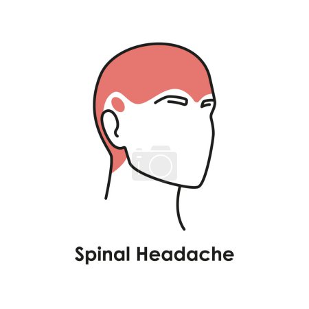 Illustration for Spinal Headache color icon. Vector isolated illustration - Royalty Free Image