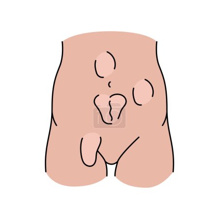 Hernias line icon. Vector isolated element.