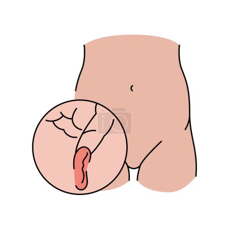 Inguinal hernia line icon. Vector isolated element.
