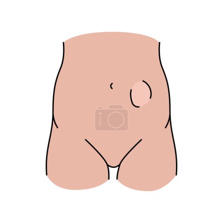 Téléchargez les illustrations : Icône de ligne de hernie intestinale. Élément isolé vectoriel. - en licence libre de droit