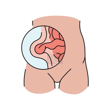 Ventral hernia line icon. Vector isolated element.