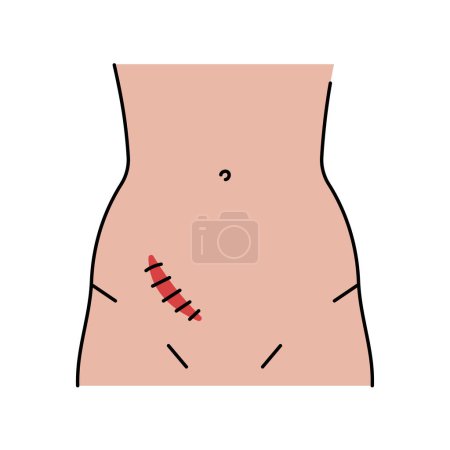 Téléchargez les illustrations : Icône de ligne d'incision de combat. Incisions abdominales. - en licence libre de droit