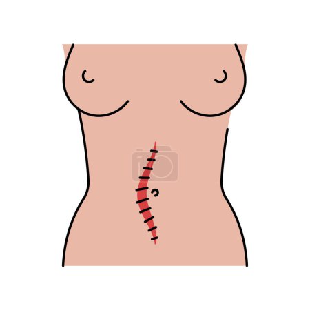 Mildline incision line icon. Abdominal incisions. 