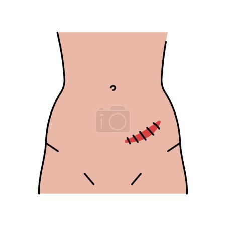 Illustration for Rutherford morrison incision line icon. Abdominal incisions. - Royalty Free Image
