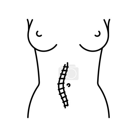 Téléchargez les illustrations : Icône de ligne d'incision Mildline. Incisions abdominales. - en licence libre de droit