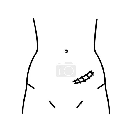 Téléchargez les illustrations : Icône de ligne d'incision de la morrison de Rutherford. Incisions abdominales. - en licence libre de droit