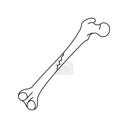 Oblique nondisplaced bone fracture  line icon. 