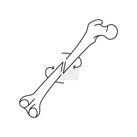 Ilustración de Icono de línea de fractura ósea espiral. - Imagen libre de derechos