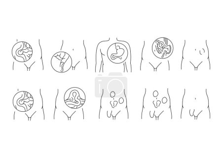 Hernias line icons set. Vector isolated element.