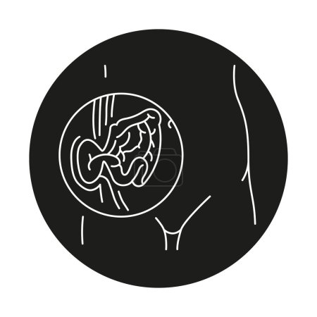 Illustration for Strangulated hernia line icon. Vector isolated element. - Royalty Free Image