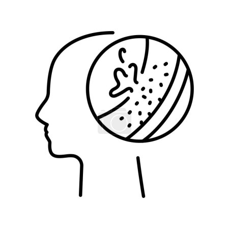 Ilustración de Icono negro de la línea de la enfermedad cerebral. Signo de enfermedad humana para la página web, aplicación móvil, - Imagen libre de derechos