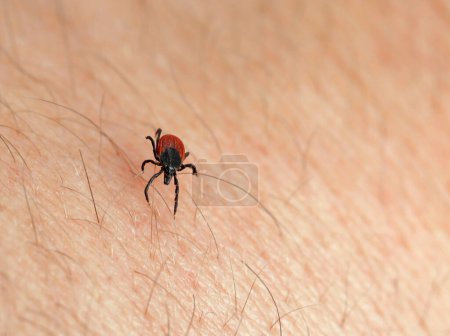 Photo for Close up of a deer tick on human skin. - Royalty Free Image