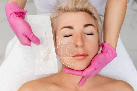 Woman's face with arrows on a cosmetology procedure of thread lifting. Cosmetologist shows the needles for the procedure. Rejuvenation and plastic surgery. Top view.