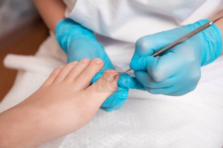 Der Fußpfleger führt eine Pediküre für den Fuß des Klienten durch, bei der die Nägel mit einer beidseitigen Kürette gereinigt werden. Aus nächster Nähe. Das Konzept der professionellen Nagelpflege und Podologie im Salon.