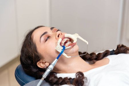 Téléchargez les photos : Gros plan d'une jeune femme caucasienne allongée à la réception dans un cabinet dentaire. Concept de dentisterie et d'orthodontie. - en image libre de droit