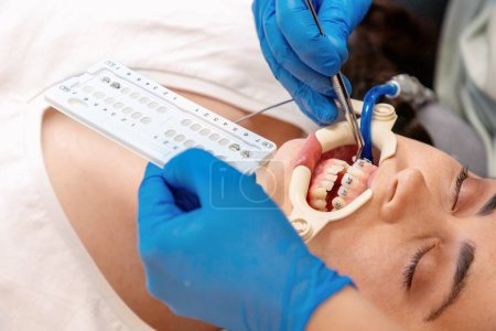 Téléchargez les photos : Gros plan de l'orthodontiste fixe des attelles de ligature sur les dents du client. Concept d'orthodontie et stomatologie. - en image libre de droit