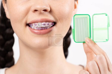 Téléchargez les photos : Gros plan de la jeune femme caucasienne avec des crochets sur les dents montrent petite boîte avec de la cire orthodontique. Fond blanc. Concept de soins dentaires pendant le traitement orthodontique. - en image libre de droit