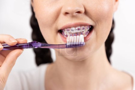 Primer plano de la joven mujer cepillándose los dientes con brackets usando cepillo de dientes manual. Concepto de cuidado dental durante el tratamiento ortodóncico.