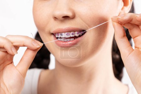 Photo for Close up of young Caucasian woman with brackets on teeth cleaning interdental space using orthodontic floss. White background. Concept of dental care during orthodontic treatment. - Royalty Free Image
