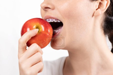 Photo for Close up of young Caucasian smiling woman with braces biting off red apple. White background. Concept of orthodontic treatment and correction of malocclusion. - Royalty Free Image