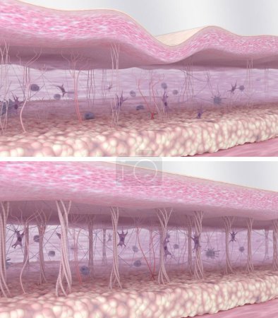 Collagen fibers regeneration in the skin tissues. Wrinkled skin before and smooth skin after anti-aging treatment or cosmetics action. Skin layers, matrix, collagen, elastin fibers, fibroblasts. Comparison of 3D illustrations of young and aged skin 