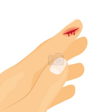 Illustration for Bleeding blood from the finger wound- vector illustration - Royalty Free Image