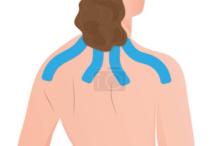 Illustration for Kinesiology taping on woman back- vector illustration - Royalty Free Image