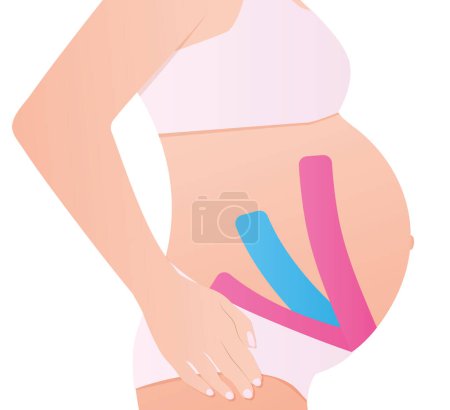 Illustration for Kinesio taping on pregnant woman -vector illustration - Royalty Free Image