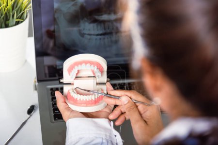 Téléchargez les photos : Oral dental hygiene. Dentist female holding professional stomatology tool and pointing healthy tooth model and explaining patient at clinic office and teeth X-ray on laptop screen, dental healthcare - en image libre de droit