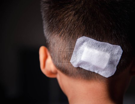 Photo for The lacerated suture wound of kid back head which suture with trauma the head by medical bandage, Medical care of the surgery lesion on the head, children of Accident - Royalty Free Image