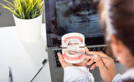 Photo for Oral dental hygiene. Dentist female holding professional stomatology tool and pointing healthy tooth model and explaining patient at clinic office and teeth X-ray on laptop screen, dental healthcare - Royalty Free Image