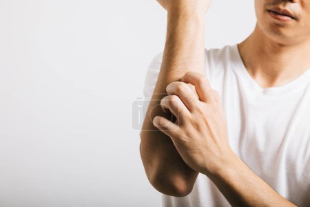 Photo for Asian man experiences itchiness on his arm, possibly due to a mosquito bite. Studio shot isolated on white background, depicting discomfort and allergy symptoms like dermatitis and scabies. - Royalty Free Image