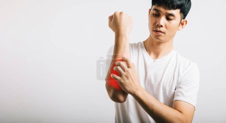 Téléchargez les photos : Portrait d'un homme asiatique avec un bras qui démange, probablement dû à une piqûre de moustique, dépeignant l'inconfort de la dermatite et de la gale, ainsi que les symptômes d'allergie. Studio tourné isolé sur fond blanc. - en image libre de droit