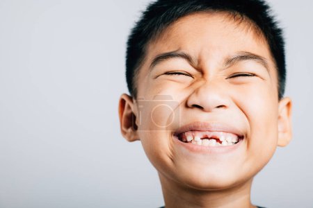 Téléchargez les photos : Un gamin souriant avec une dent supérieure perdue montre un écart. La croissance dentaire de l'enfant isolé sur blanc. Joyeux moment de fée dentaire. Les enfants montrent des dents nouveau fossé, problèmes de dentiste. petit garçon pas de dent - en image libre de droit