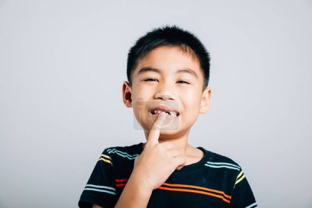 Téléchargez les photos : Enfant un garçon asiatique pointe vers la dent avant manquante symbolisant les soins dentaires. Isolé sur fond blanc mettant l'accent sur la croissance des trous et l'hygiène buccodentaire. Les enfants montrent les dents nouvel écart, problèmes de dentiste - en image libre de droit