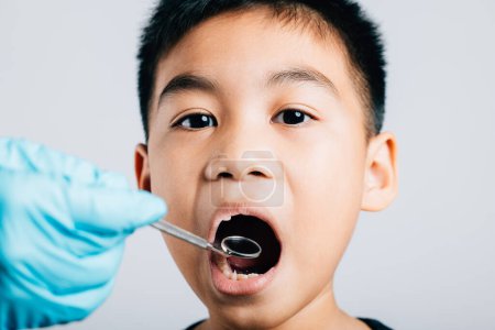 Téléchargez les photos : Un dentiste pédiatrique examine une bouche d'enfant après avoir extrait une dent de lait en vrac. Les outils dentaires facilitent le processus d'examen dans un cabinet dentaire. Le médecin utilise un miroir buccal pour vérifier la cavité dentaire - en image libre de droit