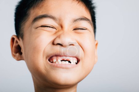 Photo for Smiling schoolboy tooth lost gap shows. Child isolated portrait on white. Joyful dental growth development. Children show teeth new gap, dentist problems. little boy no tooth - Royalty Free Image